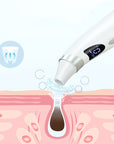 Electric Visual Blackhead Suction Instrument Household Cleansing Pore Cleaner For Skin Equipment Skin Care Tool