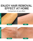 CJEER Upgraded Crystal Magic Hair Removal For Women And Men Physical Exfoliating, Painless Tool For Legs, Back & Arms